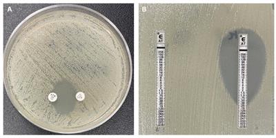 Aztreonam-avibactam synergy, a validation and comparison of diagnostic tools